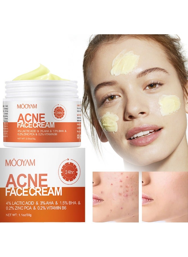 MOOYAM Acne Face Cream-4% Lacticacid & 3% AHS & 1.5% BHS  &0.2% Zinc Pca & 0.2% Vitamin B6, Lactic Acid Treatment Cream Acne AHA Face Cream Anti-Acne Moisturizer 30g - Image 1