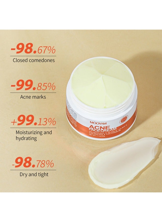 MOOYAM Acne Face Cream-4% Lacticacid & 3% AHS & 1.5% BHS  &0.2% Zinc Pca & 0.2% Vitamin B6, Lactic Acid Treatment Cream Acne AHA Face Cream Anti-Acne Moisturizer 30g - Image 4