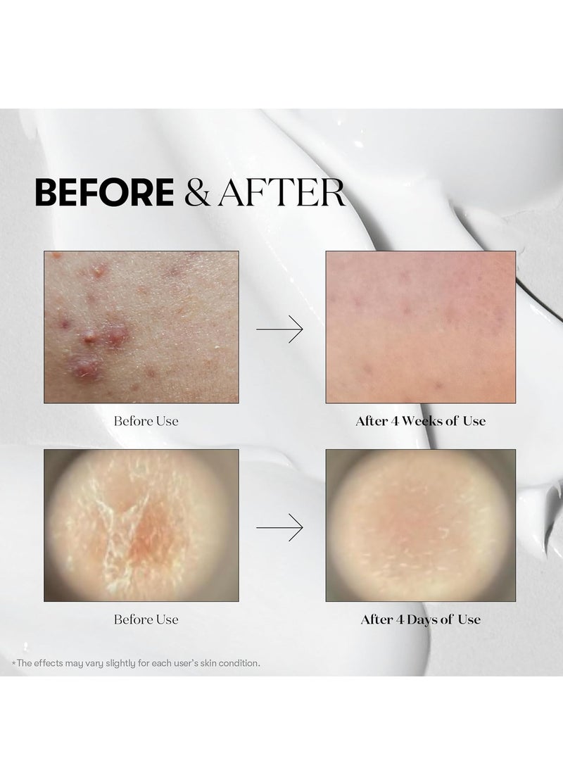 VT COSMETICS VT - Snail Reedle Shot 100B Essence 50ml - Image 4