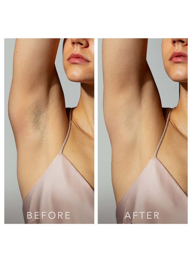 Foreo Peach™ 2 IPL Hair Reduction Device Peach 1unit - Image 3