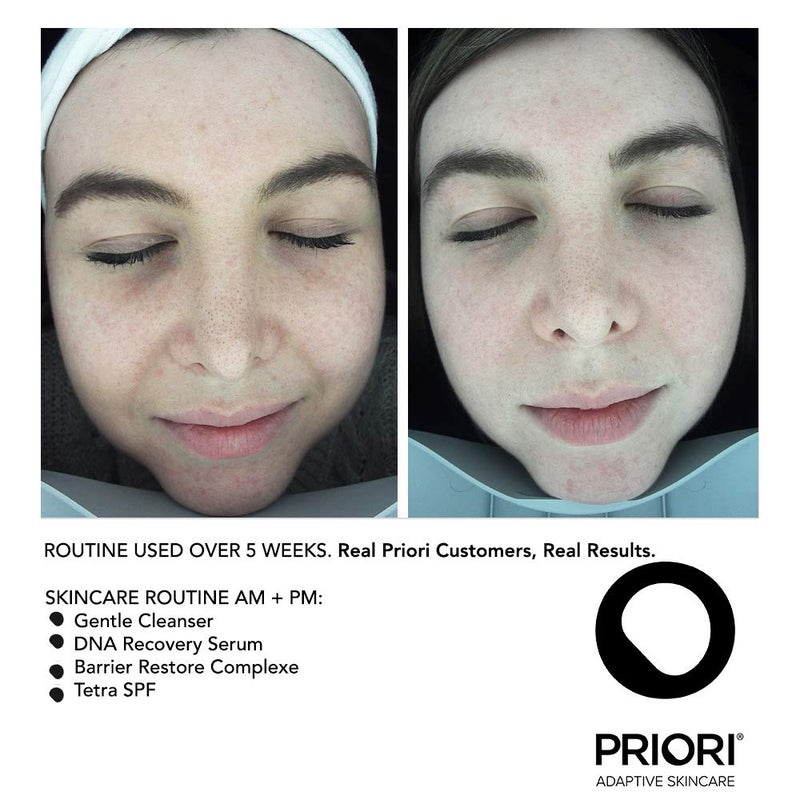 PRIORI منظف وجه لطيف من PRIORI للعناية بالبشرة مع حمض اللاكتيك، والفيتامينات A، C، E ترطيب مكثف تقشير خفيف للنساء والرجال لجميع أنواع البشرة خالي من العطور مختبر من قبل أطباء الجلد 6 أونصة سائلة - Image 5