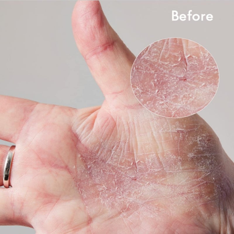 Lanolips 101 Dry Skin Super Cream - Body Cream & Face Moisturizer - Whipped Body Butter for Dry Skin - Triple Lanolin, Sweet Almond Oil, Shea Butter & Vitamin E Infused Body Care (2.02 oz) - Image 3