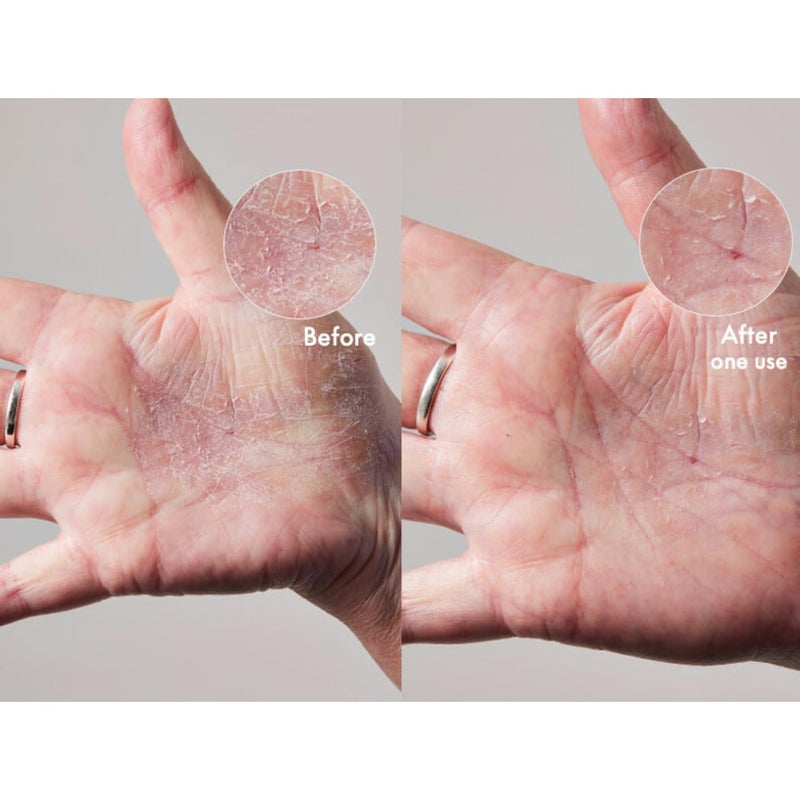 Lanolips 101 Dry Skin Super Cream - Body Cream & Face Moisturizer - Whipped Body Butter for Dry Skin - Triple Lanolin, Sweet Almond Oil, Shea Butter & Vitamin E Infused Body Care (2.02 oz) - Image 2