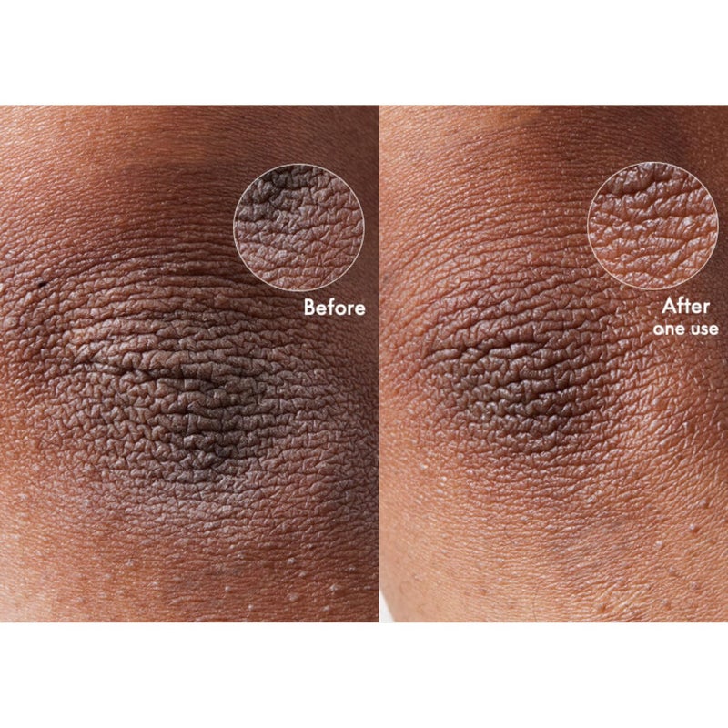 Lanolips 101 Dry Skin Super Cream - Body Cream & Face Moisturizer - Whipped Body Butter for Dry Skin - Triple Lanolin, Sweet Almond Oil, Shea Butter & Vitamin E Infused Body Care (2.02 oz) - Image 4