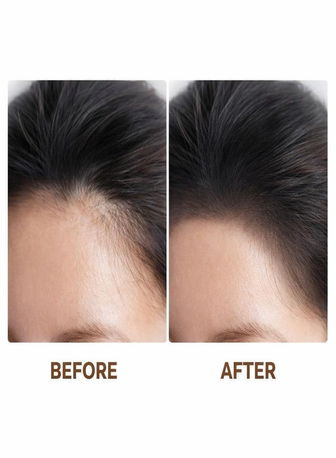 Red Champion Hairline Touch-Up Powder Stick Instant Hair Root Cover Powder with Sponge Applicator Temporary Hairline Shading for Men & Women Black Pack of - Image 4