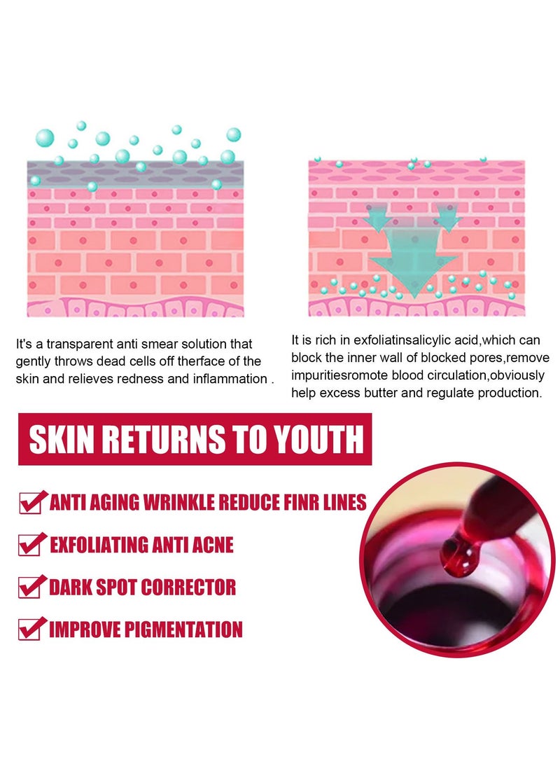 EELHOE AHA30%+BHA 2% salicylic acid essence - Image 5