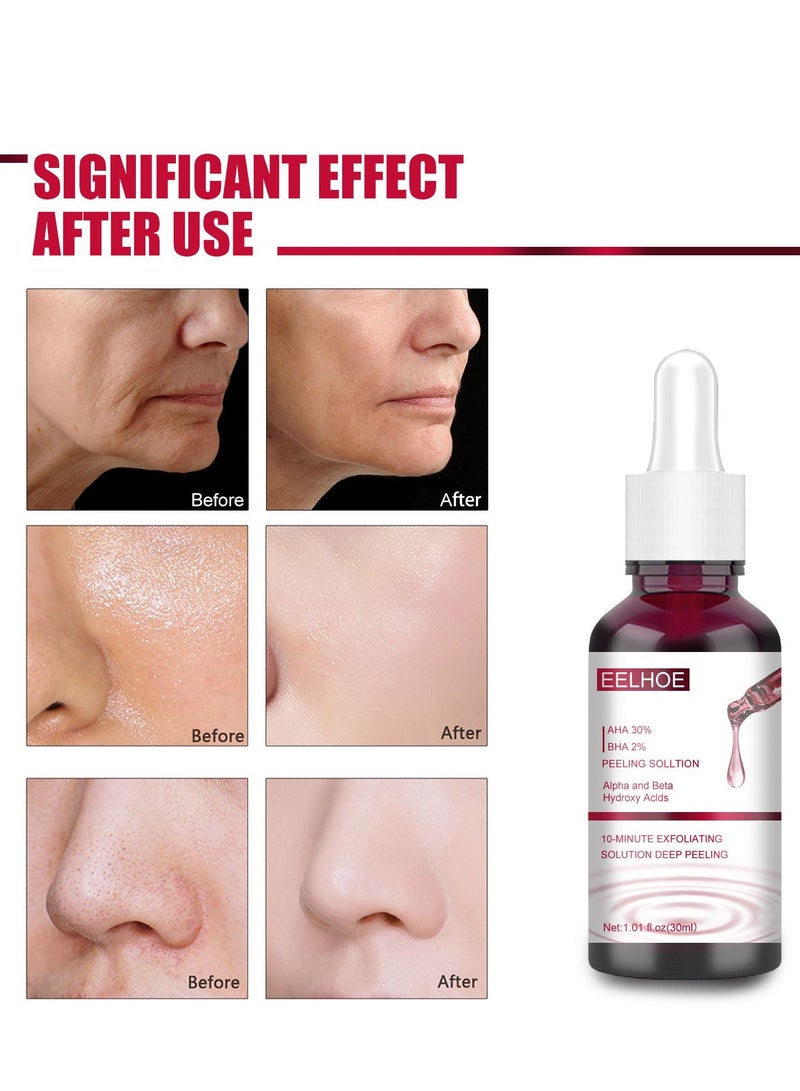 EELHOE AHA30%+BHA 2% salicylic acid essence - Image 2