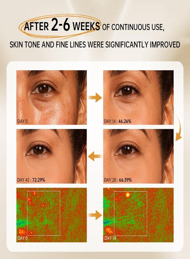 VGO Bakuchiol Retinol Serum, 1% Retinol for Anti-Aging and Anti-Wrinkle, Gentle Yet Potent Formula for Sensitive Skin. - Image 4