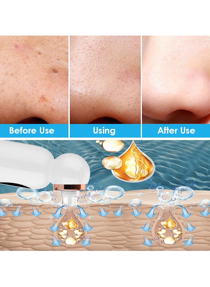 USB Rechargeable Blackhead Remover Vacuum Cleaner for Facial Cleansing - Image 4