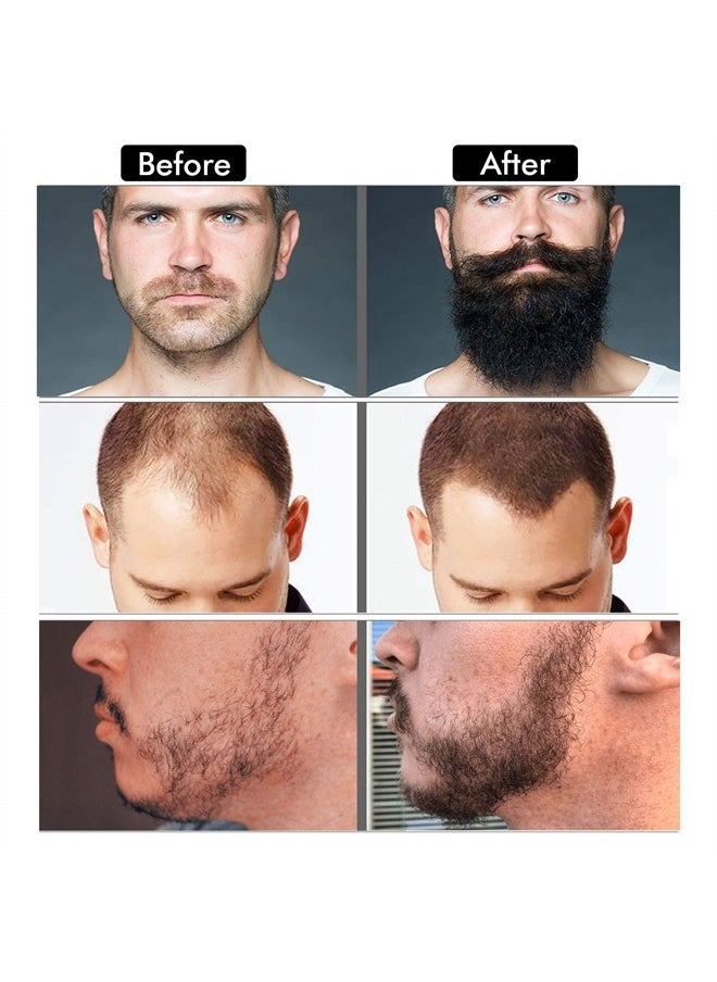 Naland - Beard Growth Kit - Derma Roller, Serum Oil (2oz), Balm and Comb, Stimulate Beard and Hair Growth - Gifts for Men Dad Him Boyfriend Husband Brother - Image 1