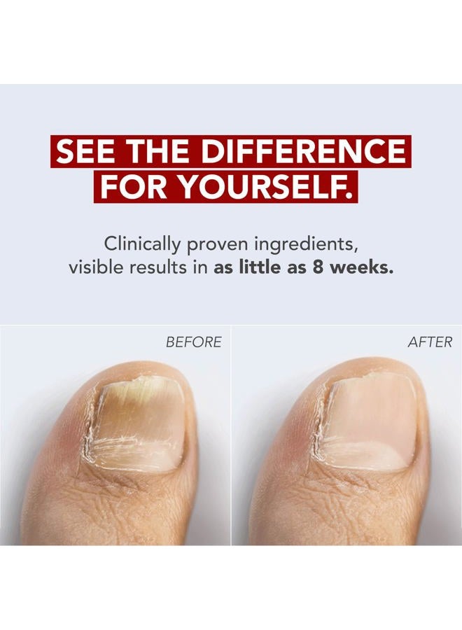 Kerasal Fungal Nail Renewal, Restorative Repair for Damaged Nails, 2 pack - Image 2
