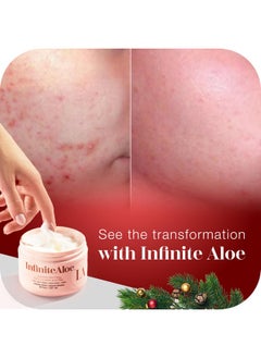 InfiniteAloe InfiniteAloe Moisturizer Face Cream Aloe Vera, for Face, Body and Hand, Complete Skin Care for all skin types, Everyday Hero Original Scent - Large Jar 8 oz & 2 Travel Jar 0.5 oz  - Image 4