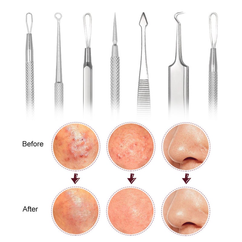 Abody 7pcs Blackhead Tool Acne Clip Facial Comedone Needle Set Facial Pimple Tweezer Stainless Steel Blemish Extractor - Image 5