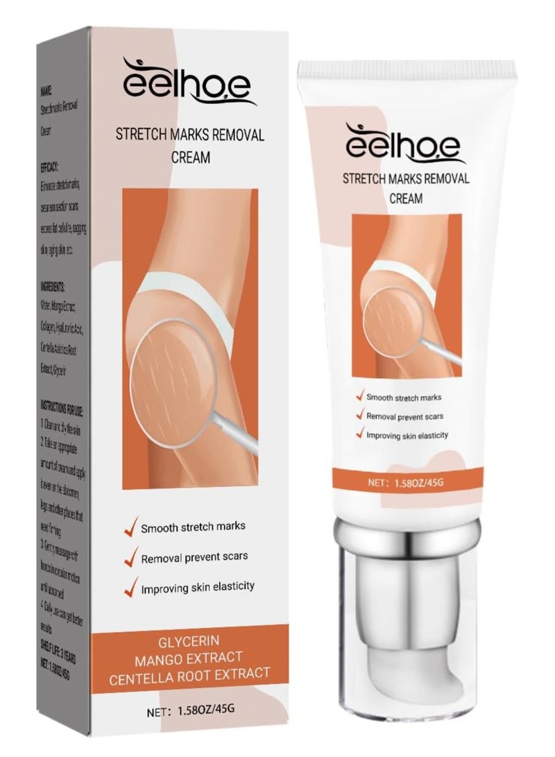 EELHOE Dermease Stretchmarks Removal Cream, Stretch Mark Removal Cream, Stretch Mark Scar Cream, Scar Cream Gel, Scar Care Cream, Help with Stretch Marks, Surgery, Injury, and Burns Scars - Image 1