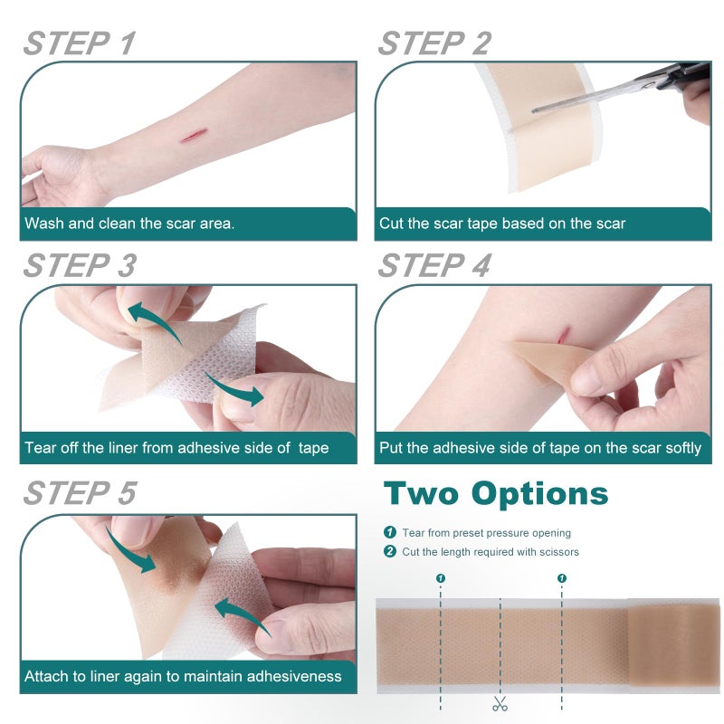 SLUKHIG Silicone Scar Sheets (1.6"x 158" Roll-4M), Silicone Scar Tape for Scar Removal Treatment, Reusable Silicone Scar Strips for C-Section, Keloid, Burn, Acne, Surgical Scars - Image 5
