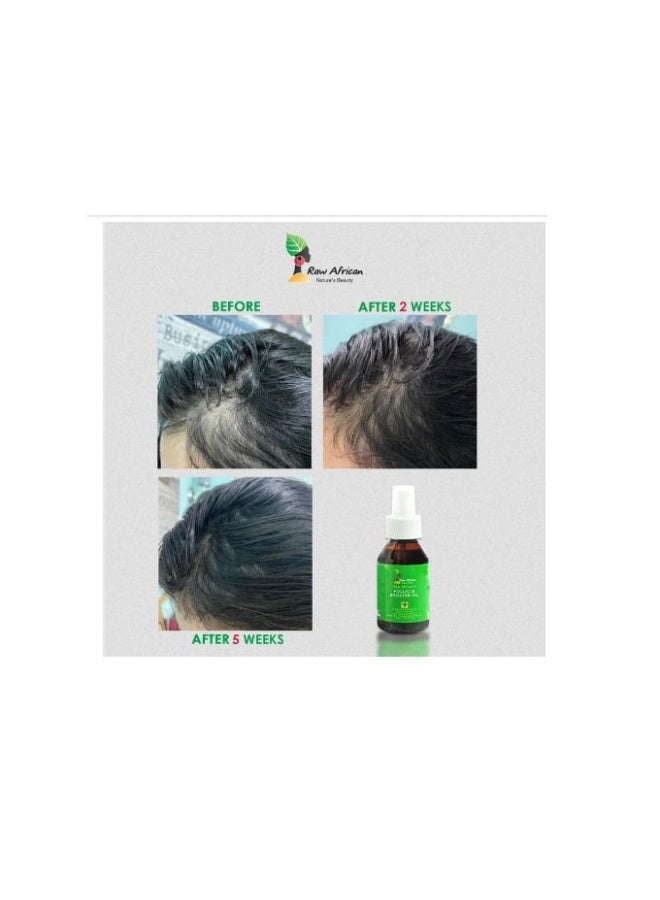 رو أفريكان زيت فوكل بوسطر (Follicle Booster) من راو أفريكان – 100 مل – لتحفيز نمو الشعر - Image 5