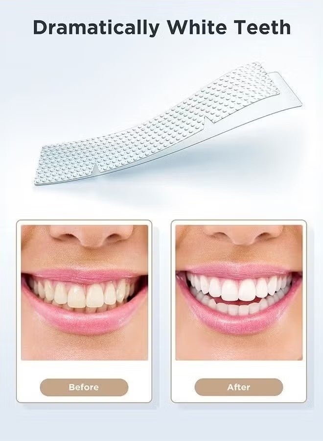 AHVTE 28 Pcs 5D Teeth Whitening Kit, Teeth Whitening Strips for Sensitive, Professional Effects, 28 Strips Whitener Safe Whitestrip, Deep Stains Removal Tooth Whitening - Image 2