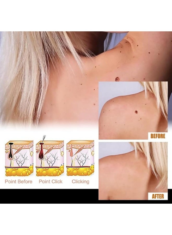 إيلهو سيروم محترف لإزالة الثآليل والشامات، 10 مل - مصحح دقيق للجلد لطيف للوجه والرقبة والجسم مع الجليسرين والبنتينول - علاج سريع لفرط الجلد - Image 5