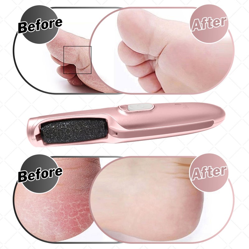 Care Me Powerful Electric Callus Remover Wand â€“ Rechargeable Foot File, Grinder & Scrubber - Removes Dead, Hard Skin & Calluses â€“ Best Pedicure Tool for Soft, Smooth Feet for Men & Women (Rose Gold) - Image 5