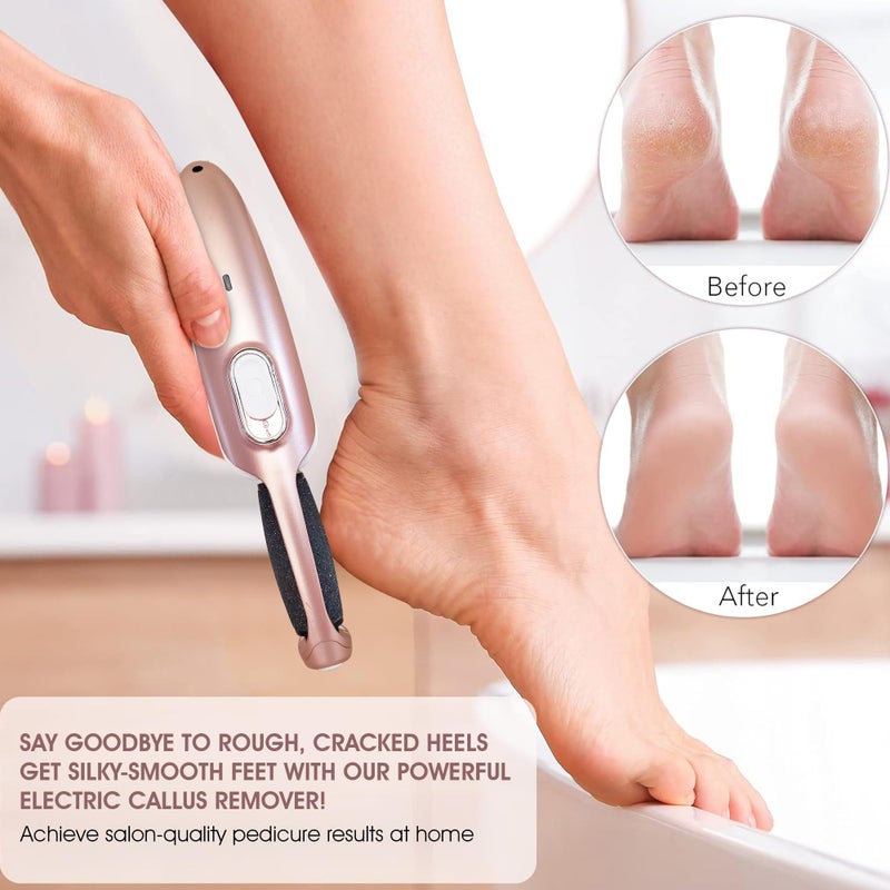 Care Me Powerful Electric Callus Remover Wand â€“ Rechargeable Foot File, Grinder & Scrubber - Removes Dead, Hard Skin & Calluses â€“ Best Pedicure Tool for Soft, Smooth Feet for Men & Women (Rose Gold) - Image 4