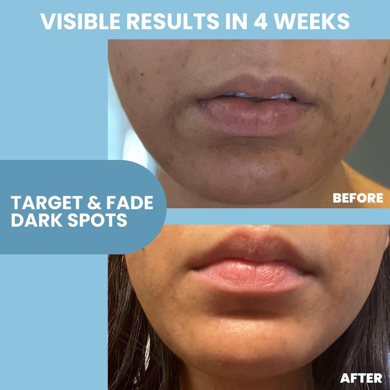 Eva Naturals Niacinamide 12% + Zinc Serum for Face â€“ Dark Spot Remover, Pore Minimizer, Redness Relief, Hydrating Vitamin B3 with Botanical Hyaluronic Acid, Anti-Aging Serum for Clear Skin (2 Pack) - Image 3