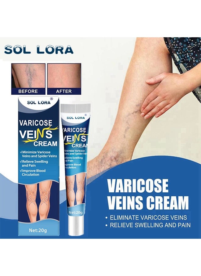 SOL LORA - Varicose Vein Cream, Improves Blood Circulation, Reduces Spider Veins And Heaviness, Improve Blood Circulation, Tired And Heavy Legs, 20G - Image 1