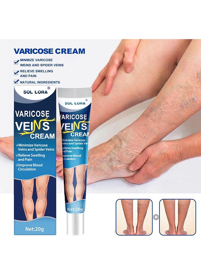 SOL LORA - Varicose Vein Cream, Improves Blood Circulation, Reduces Spider Veins And Heaviness, Improve Blood Circulation, Tired And Heavy Legs, 20G - Image 1