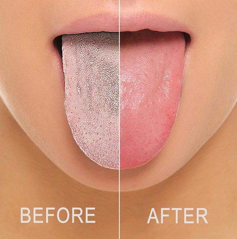 Calitate24 Calitate 2Pcs Bathing Sponges Korean Body Scrub Sponge Baby Bath Sponge Ultra Soft & Bouncy Dead Skin Removing Sponges with 1 Tongue Cleaner - Image 5