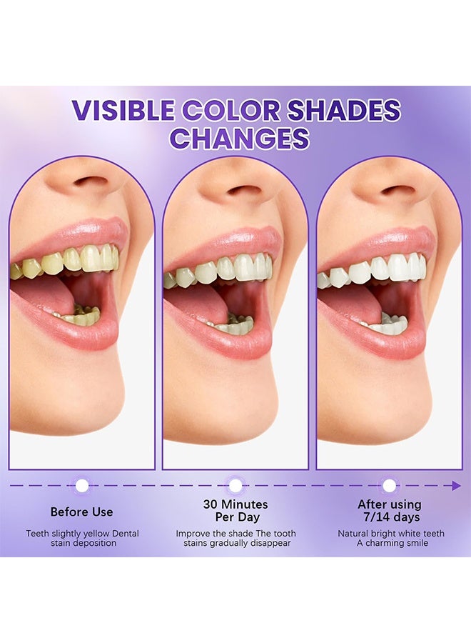 ORALHOE Shine Whitening Patches, Purple Instant Whitening Strips, V34 Teeth Whitening Strips, Purple Tooth Whitening, Tooth Stain Treatment, Gum Care & Stain Removal, Removes Yellow Stains & Bad Breath, Combining Whitening And Colour Correction 7 Pieces - Image 3