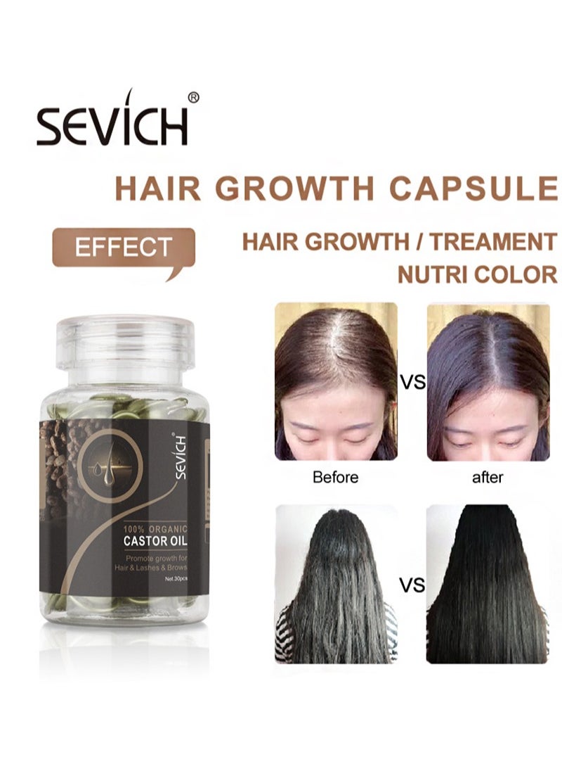 Sevich Black Castor Hair Repair Oil Capsules, Suitable For Restoring Dry And Damaged Hair, Hair Care Essence Capsules With Organic Castor Oil, Argan And Avocado Oils (30 Capsules)  - Image 2
