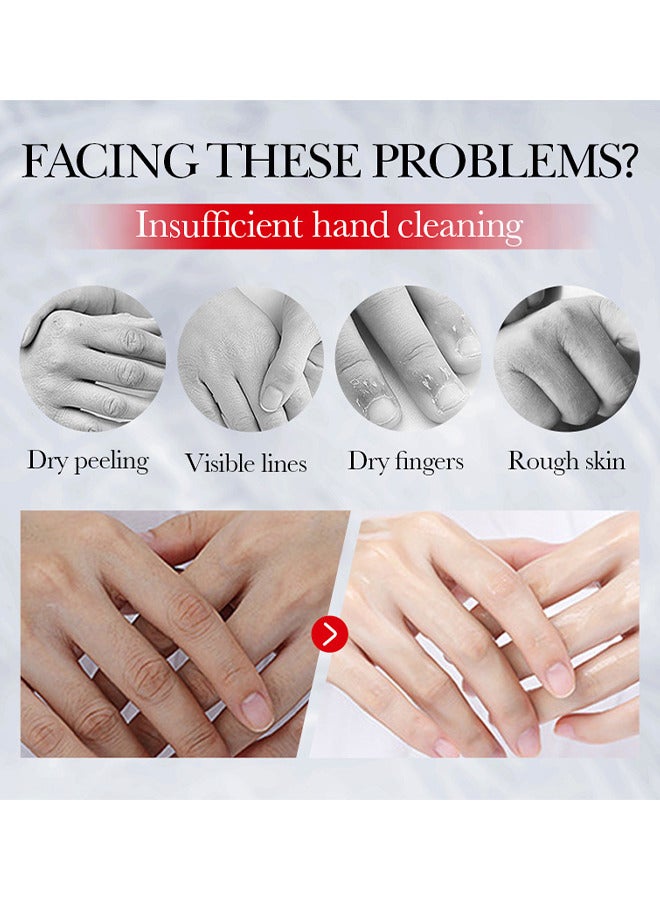 SADOER 3 PCS Kojic Acid Hand Cream, Kojic Acid Cream Sadoer, Whitening Freckles Kojic Acid Hand Cream, Sadoer Kojic Acid, Niacinamide Hyaluronic Acid Kojic Acid Whiten Tender Hand Cream - Image 4