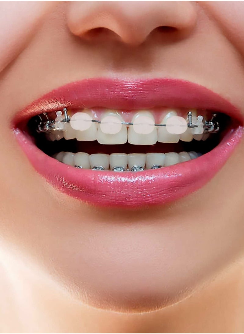 Orthodontic Wax for Braces, 6 Boxes Dental Wax Brace Wearer Wax for Braces Protection(Blue Mint Flavor)