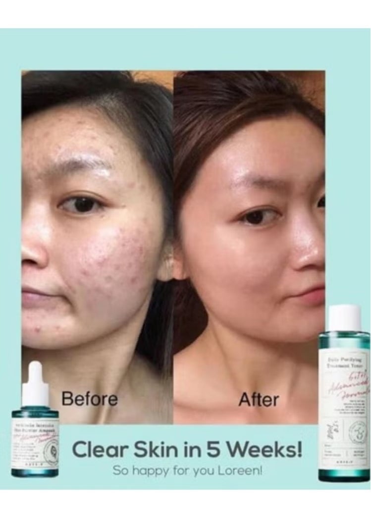 Daily Purifying Treatment Toner 200ml + Artichoke Intensive Skin Barrier Ampoule 30ml