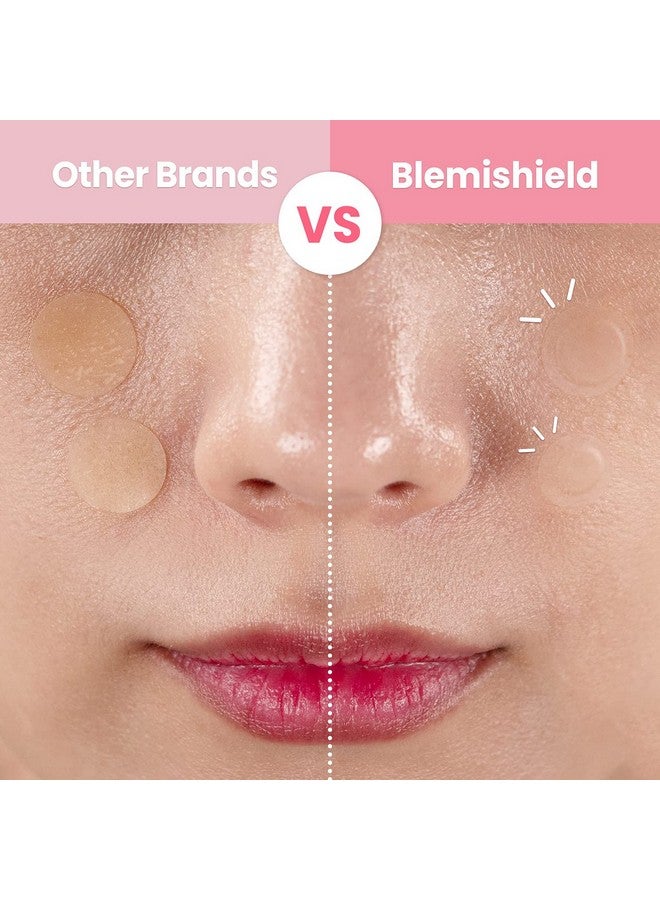 Glam Up Hydrocolloid Blemish Pimple Zit Patches(180Pcs/2Size) - Invisible Ultra Thin Spot Cover Stickers For Face And Skin, Strong Water-Proof And Adhesive Overnight, Vegan-Friendly - Image 2