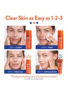AcneFree AcneFree Severe Acne 24 Hour Clearing System for stubborn acne, 4 Step Routine Kit  - Image 4