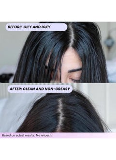 FoxyBae FoxyBae Turned Up Dry Shampoo Spray - Dry Shampoo for Women with Biotin for Hair Growth - Volumizing, Refreshing & Non-Toxic - 7 Fl Oz  - Image 1