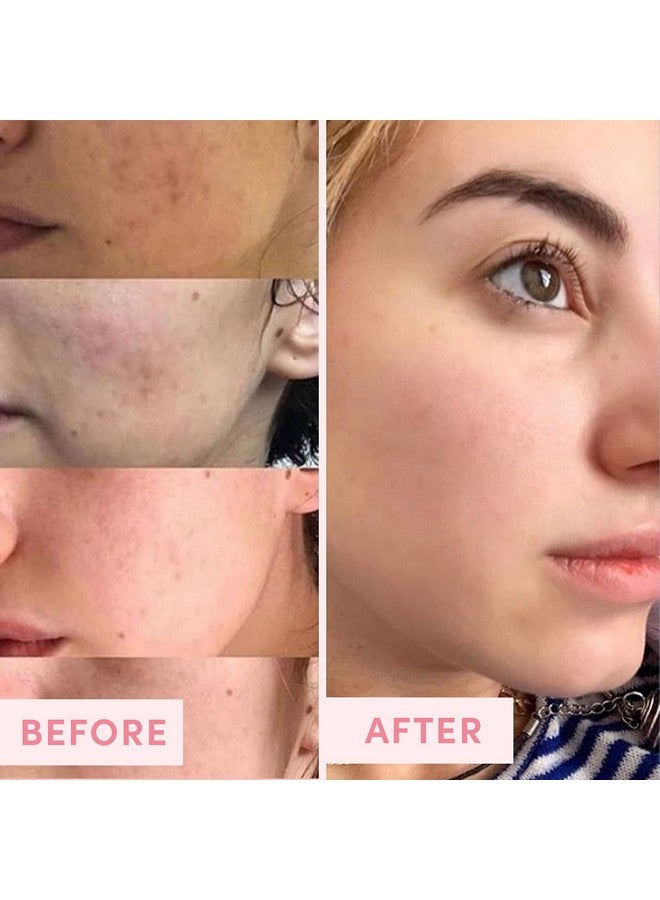 Sand & Sky Australian Pink Clay Porefining Mask For Blackheads. Evens Skin Tone. - Image 5