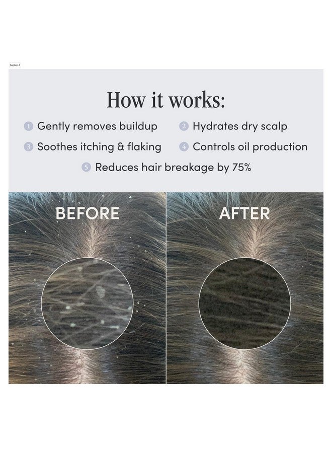 Jupiter Anti Dandruff Shampoo For Women & Men Physicianformulated For Flaky Itchy Oily Dry Scalp Treatment Vegan Sulfate Free Color Safe & Paraben Free Scalp Psoriasis Shampoo With Zinc - Image 5