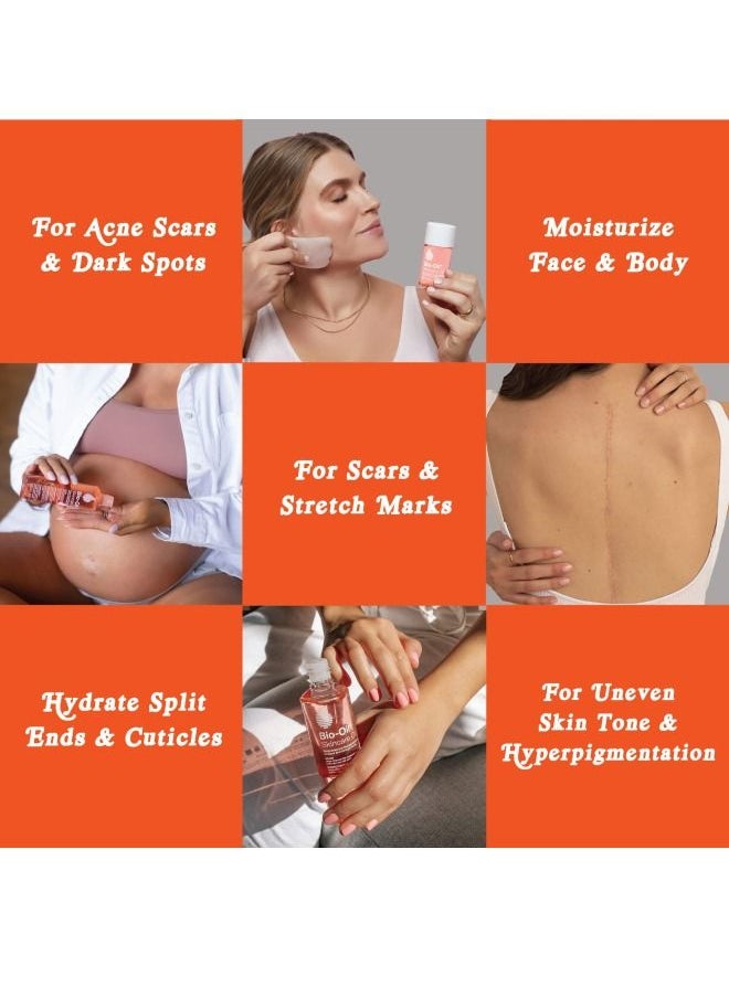 Bio-Oil - Skincare Oil for scar & Stretch Marks 60ml - Image 1