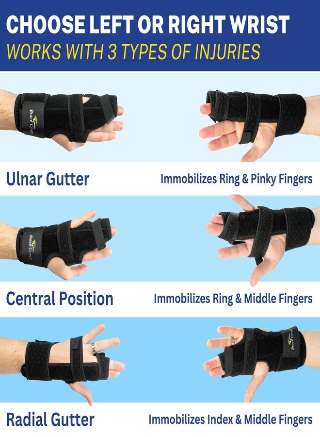 Brace Direct Pro Boxer Metacarpal Hand Fracture Splint - Right - 3-in-1 Adjustable Hand Brace for 2nd, 3rd, 4th, & 5th Finger Support - Ulnar & Radial Gutter Splint for Boxer’s Fracture, Broken - Image 3