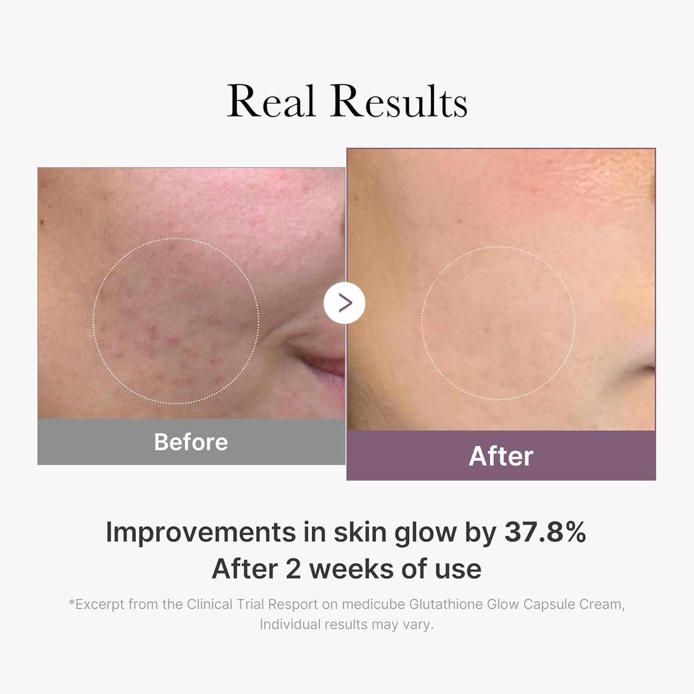 glutathione peptide before and after Medicube AGE-R Glow Capsule Facial Cream - Instant Lifting Moisturizer - Collagen For Hydrating Glow - Improve Blemishes, Uneven Skin Tone - Korean Skin Care | Best Price Kuwait Nanofood Choose Your Bundle::8oz | 25Pack Solgar® L-Glutathione Maximised 250mg