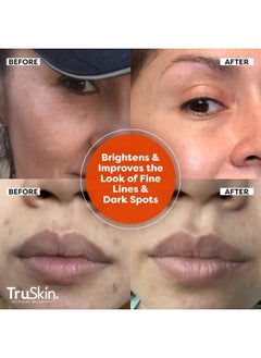 TruSkin Naturals TruSkin Vitamin C Serum For Face – Anti Aging Formula with Vitamin C, Hyaluronic Acid, Vitamin E – Brightening Serum – Improve Appearance of Dark Spots, Tone, Fine Lines & Wrinkles, 1 Fl Oz  - Image 4