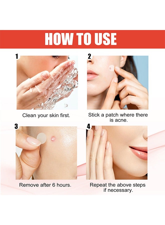 Hero 36- Piece Mighty Patch Hydrocolloid Acne Pimple Patch Spot Treatment Beige 5.5inch - Image 5