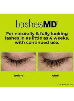 LashesMD Eyelash Growth Serum & Conditioner, 0.135 Oz. Naturally Enhances For Stronger, Thicker Lashes & Brows Paraben & Cruelty Free Clinically Formulated With Peptides & Botanicals  - Image 5