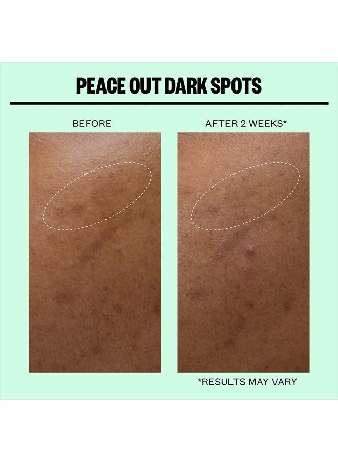 PEACE OUT - Peace Out Skincare Dark Spots. Dissolving Microneedling Dots to Reduce the Appearance of Dark Spots and Reveal Clear, Even Skin (12 dots) - Image 1