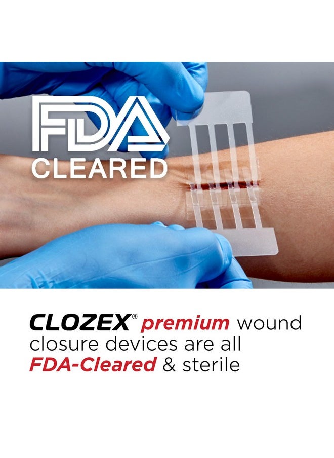 Clozex - Emergency Laceration Closures - Repair Wounds Without Stitches. Fda Cleared Skin Closure Device For 2 Individual Wounds Or Combine For Total Length Of 2 Inches. Life Happens, Be Ready! - Image 1
