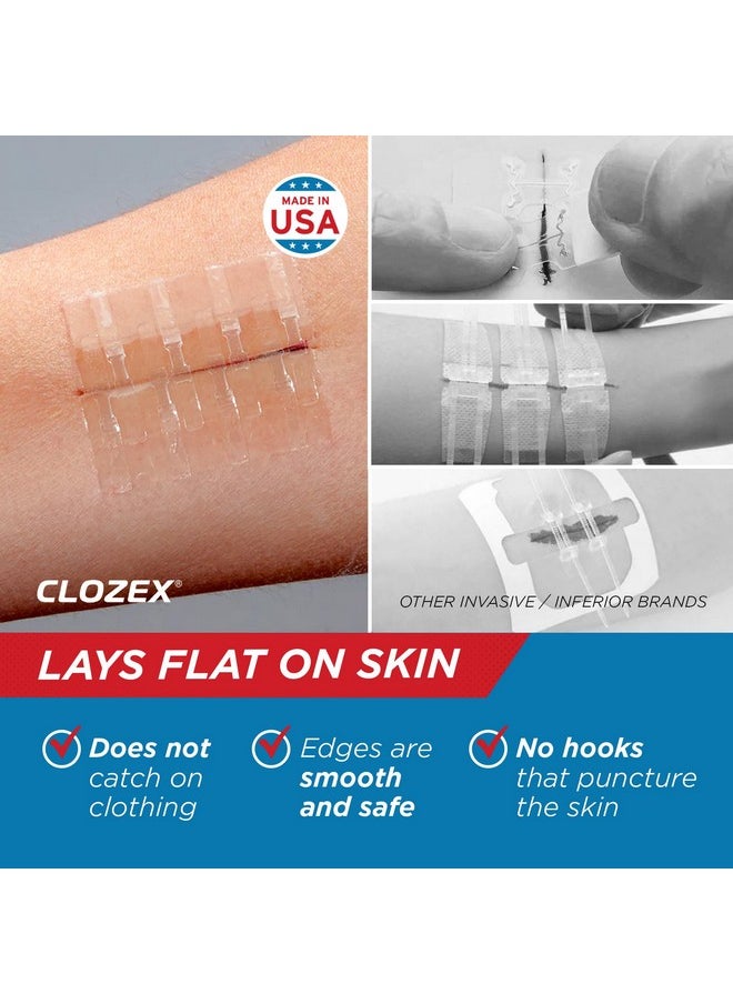 Clozex - Emergency Laceration Closures - Repair Wounds Without Stitches. Fda Cleared Skin Closure Device For 2 Individual Wounds Or Combine For Total Length Of 2 Inches. Life Happens, Be Ready! - Image 1