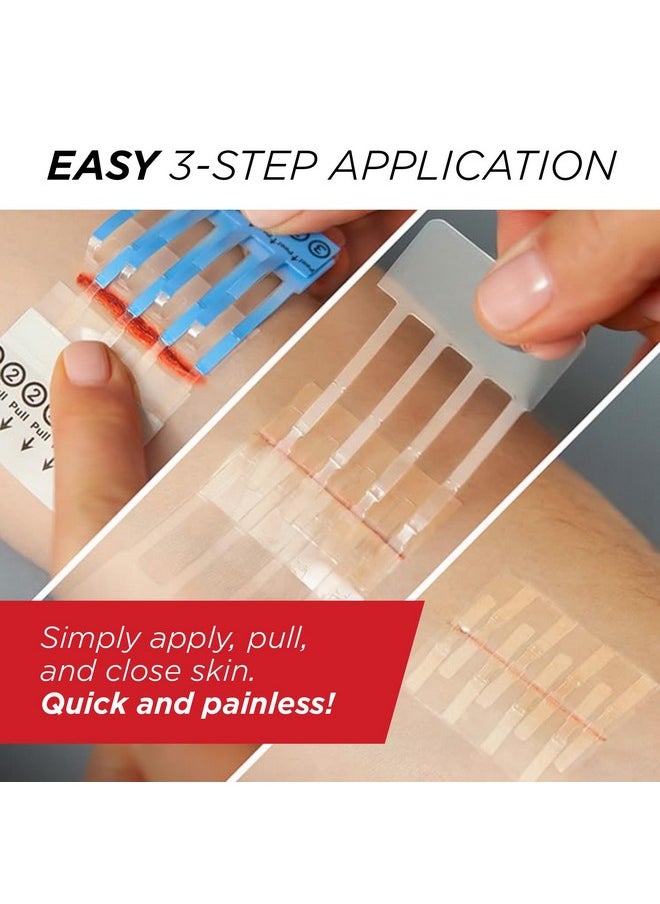 Clozex - Emergency Laceration Closures - Repair Wounds Without Stitches. Fda Cleared Skin Closure Device For 2 Individual Wounds Or Combine For Total Length Of 2 Inches. Life Happens, Be Ready! - Image 1