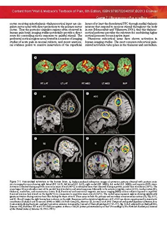 Wall & Melzack's Textbook of Pain: Expert Consult - Online and Print  - Image 4
