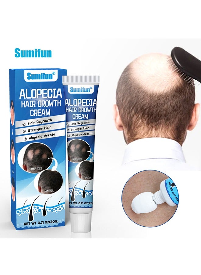 سوميفون كريم نمو الشعر الثعلبة لتعزيز نمو شعر الرجال للنساء ، ومنع تساقط الشعر ، والعناية بالشعر ، 20 جرام - Image 1